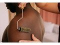 kine-a-domicile-apres-operation-reeducation-post-op-yaounde-small-1